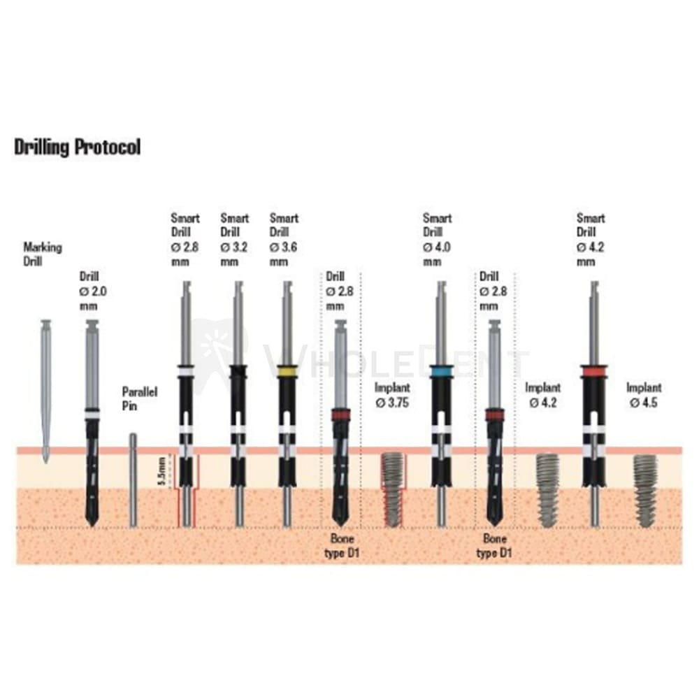 Dsi Spiral Smart Dual Thread Implant Internal Hex Dental