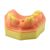 Easyinsmile Upper Jaw Model With Missing Teeth Orthodontic Wax